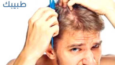 علاج تساقط الشعر عند الرجال بالأعشاب
