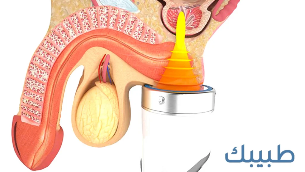 طرق علاج ضعف الانتصاب النفسي عند الرجال
