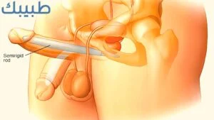 علامات تدل على الضعف الجنسي عند الرجل