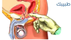 أقوى مضاد حيوي لعلاج التهاب البروستات
